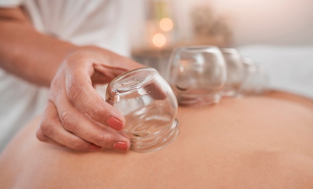 cupping massage